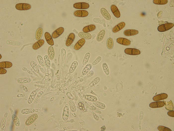macrostoma