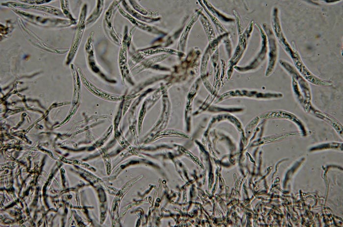macrostoma