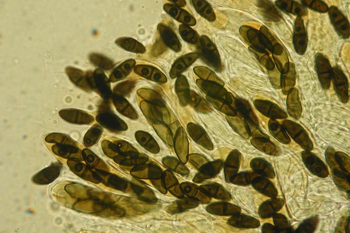 macrostoma