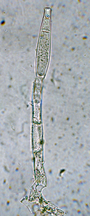 macrostoma