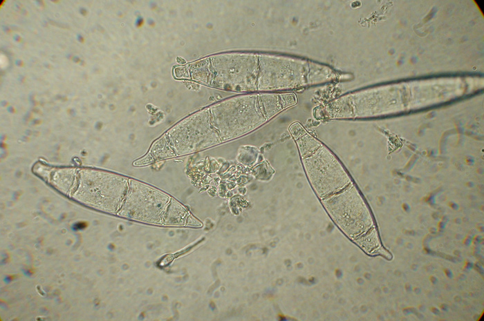 macrostoma
