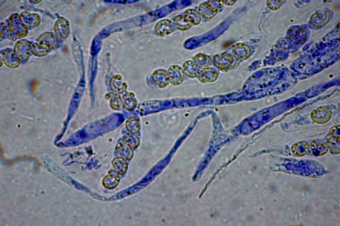 macrostoma