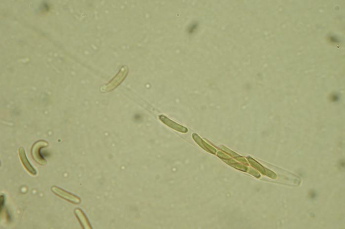macrostoma