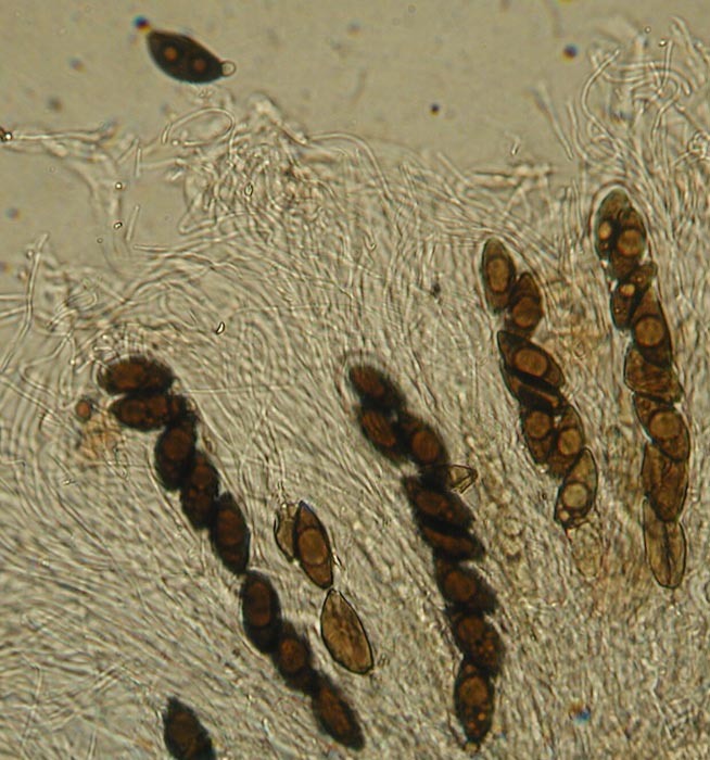 macrostoma