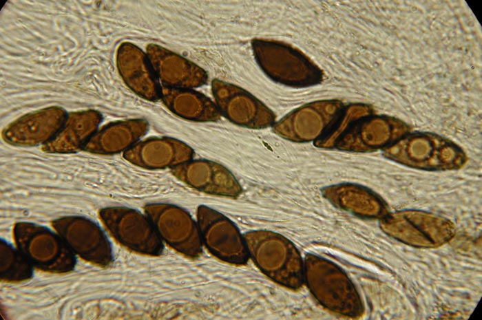macrostoma