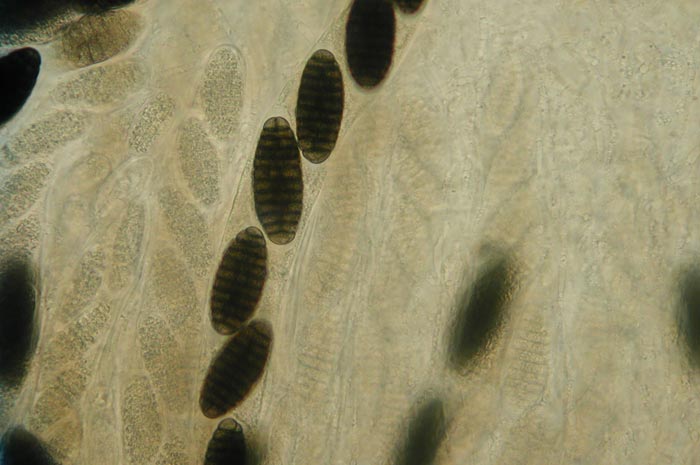 macrostoma