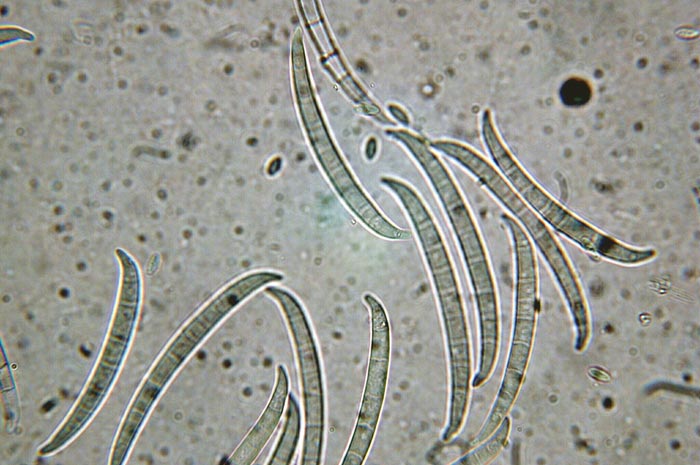 macrostoma