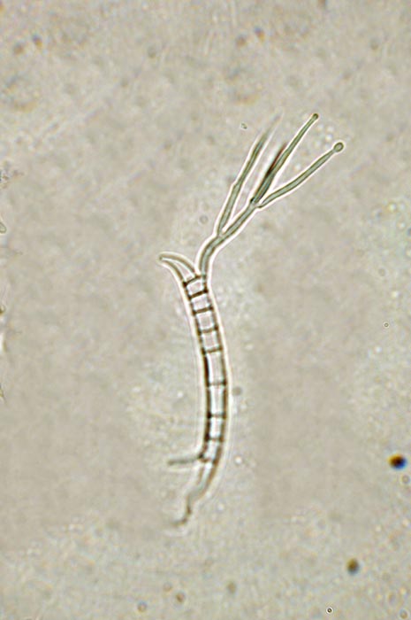 macrostoma