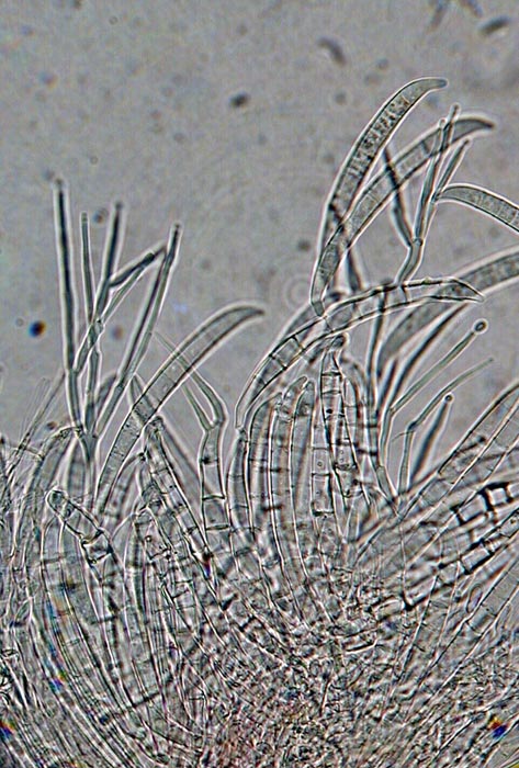 macrostoma