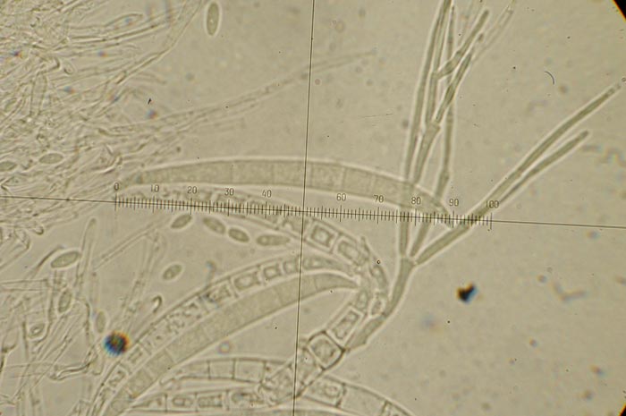 macrostoma