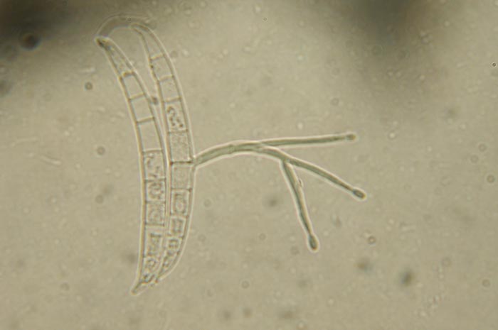 macrostoma