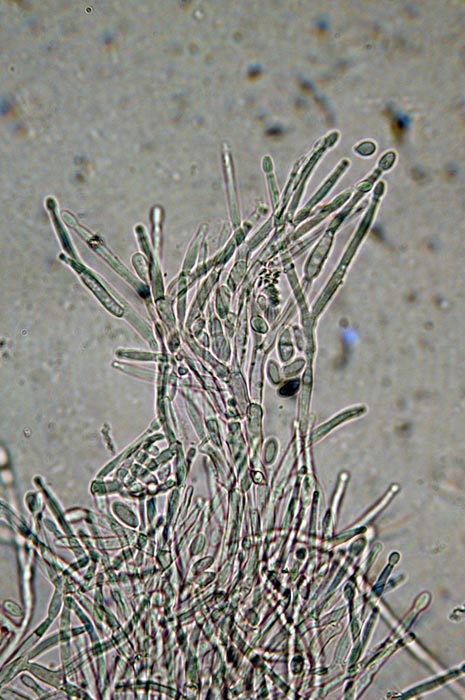 macrostoma