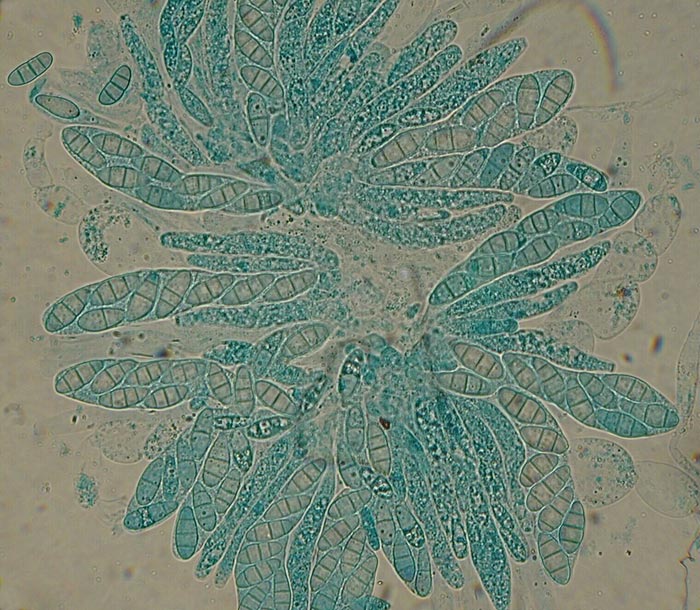 macrostoma