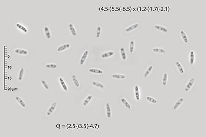 macrostoma