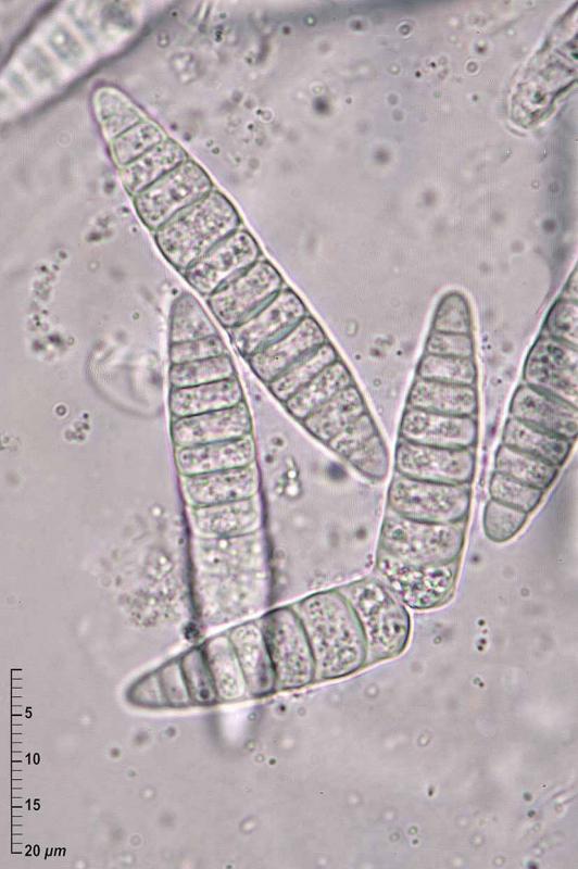 macrostoma