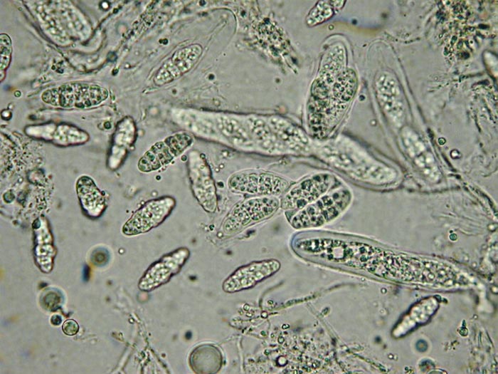 macrostoma
