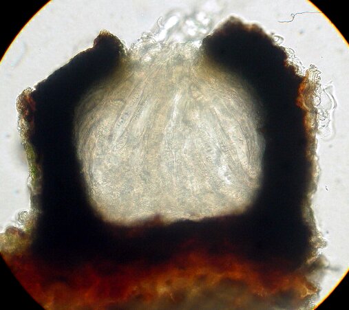 macrostoma