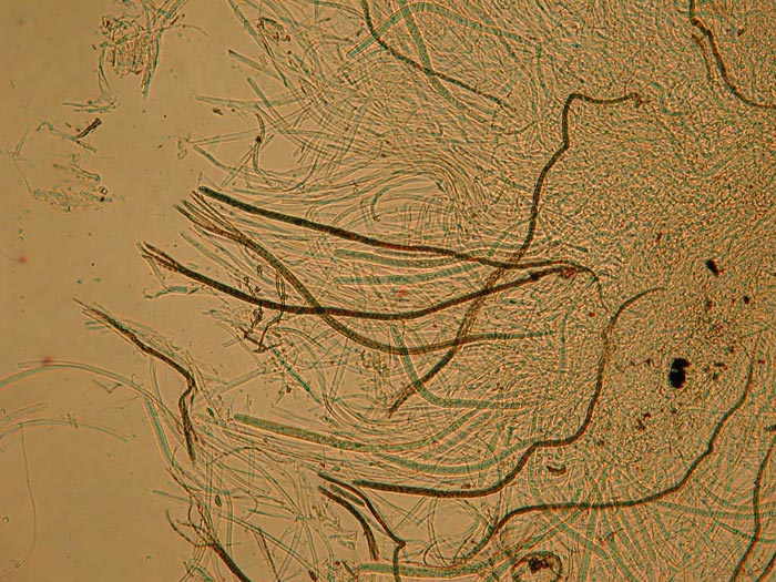 macrostoma