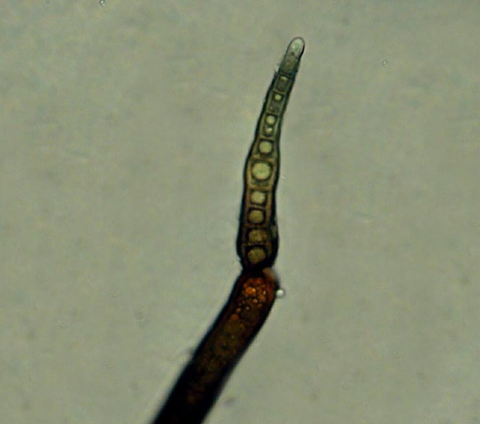 macrostoma