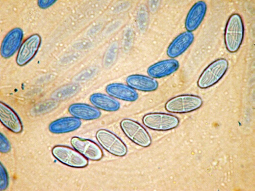 macrostoma