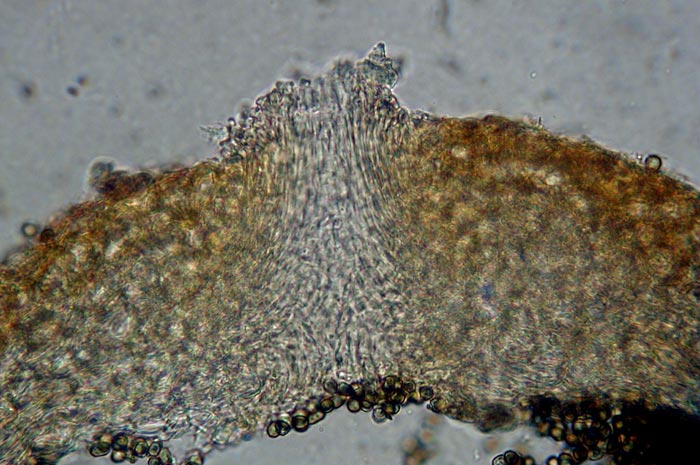 macrostoma