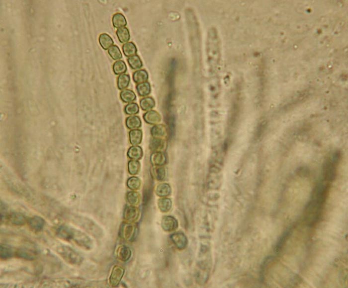 macrostoma