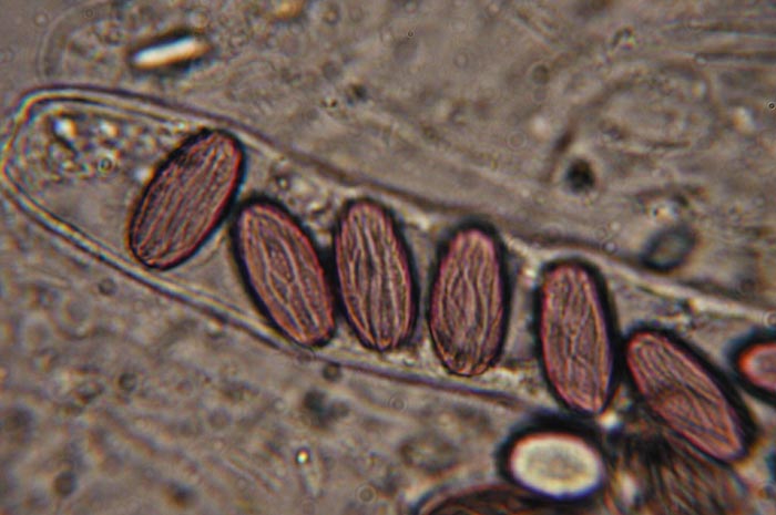 macrostoma