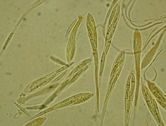 macrostoma