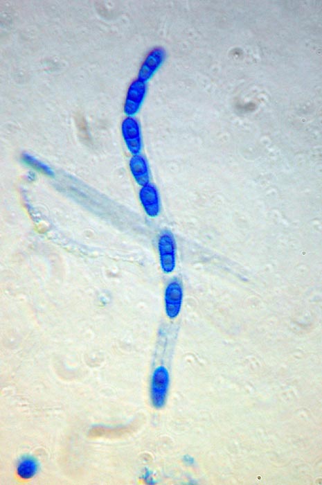 macrostoma