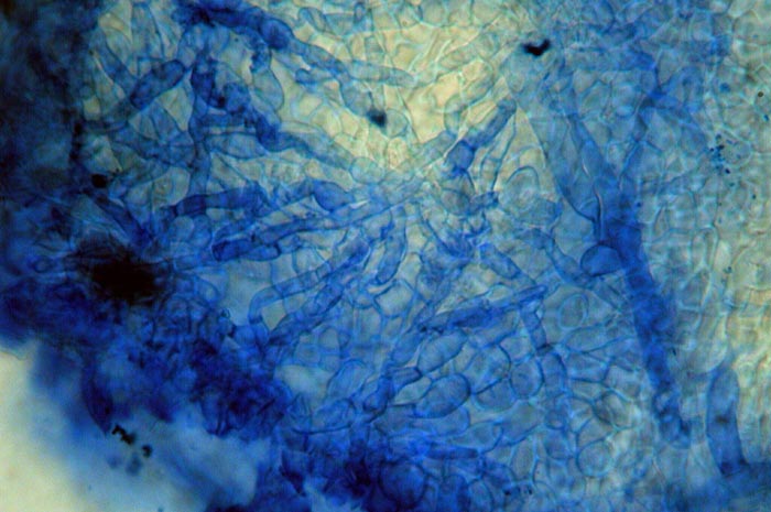 macrostoma