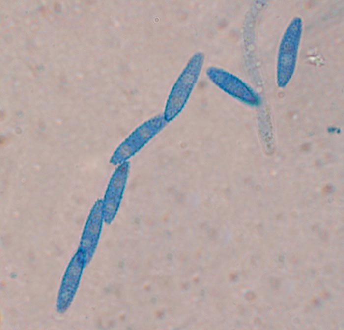 macrostoma
