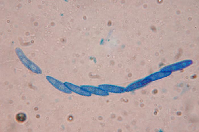macrostoma