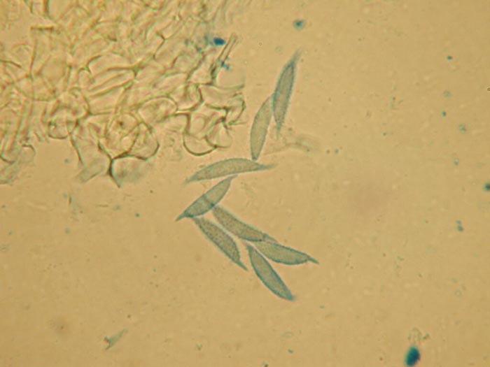 macrostoma