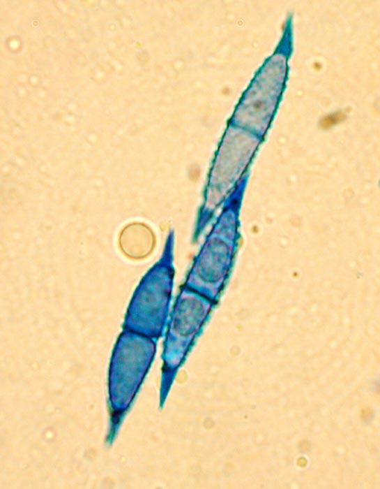 macrostoma