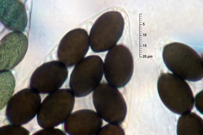 macrostoma