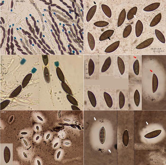macrostoma