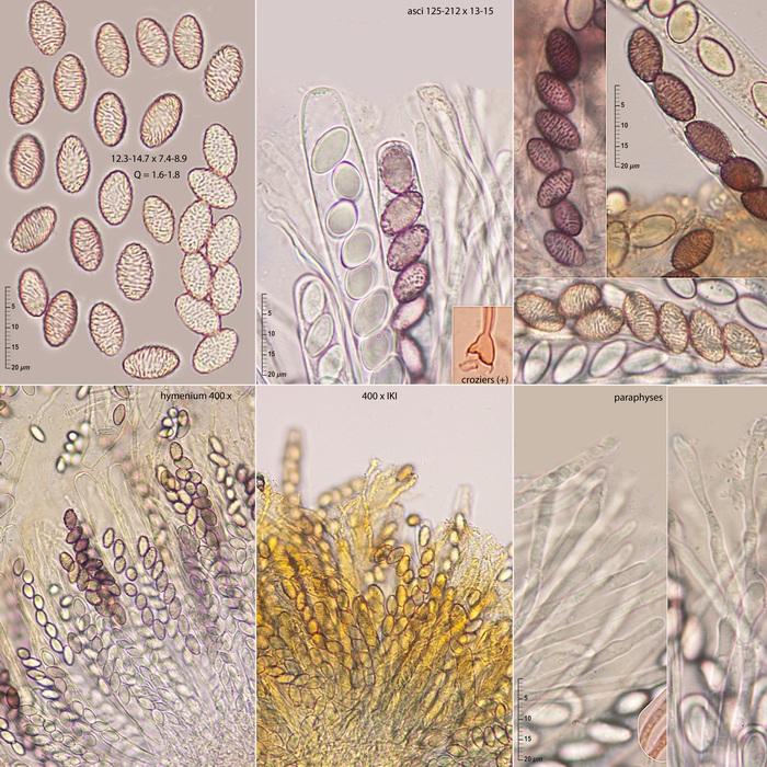 macrostoma
