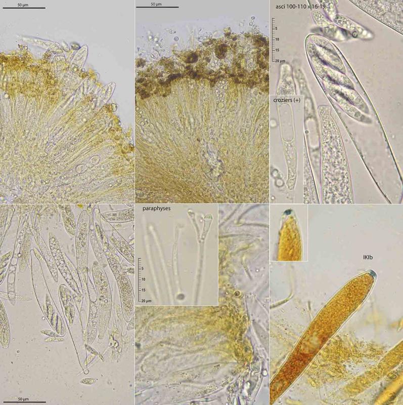 macrostoma