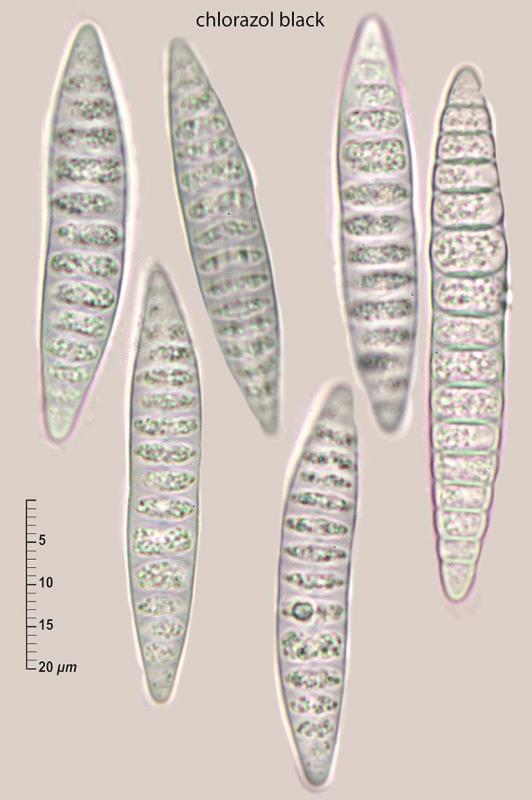 macrostoma