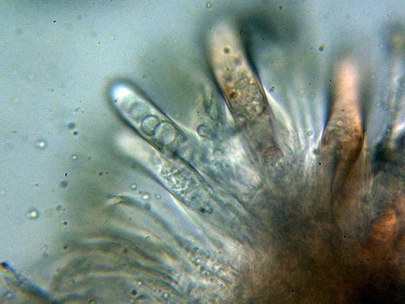 macrostoma