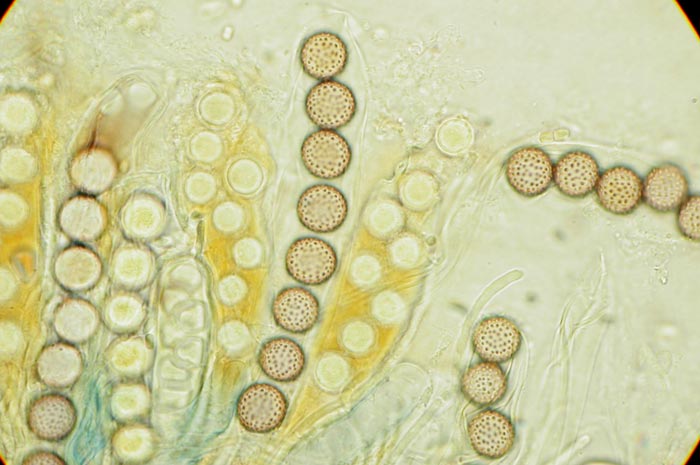 macrostoma
