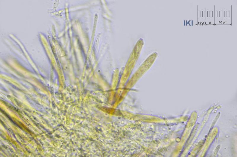 macrostoma