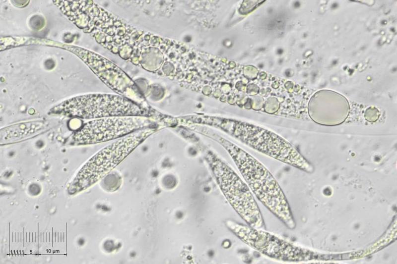 macrostoma