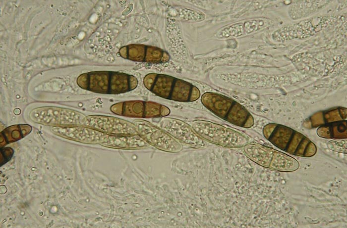 macrostoma