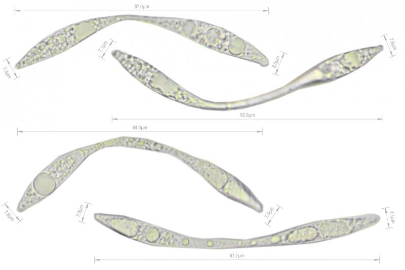 macrostoma