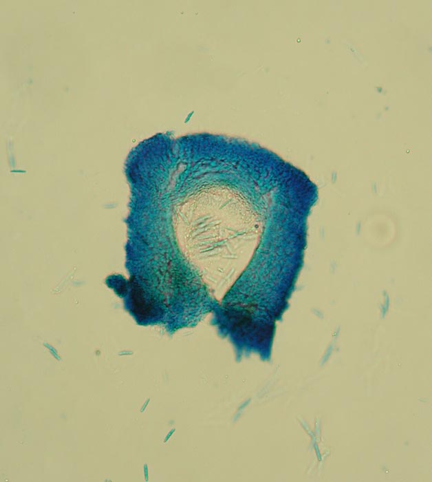macrostoma