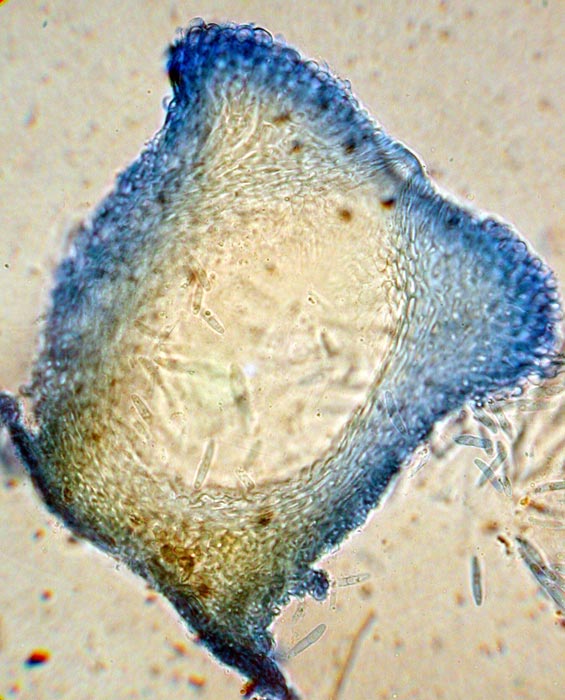 macrostoma
