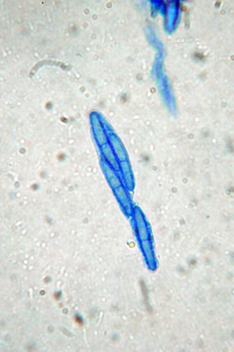 macrostoma