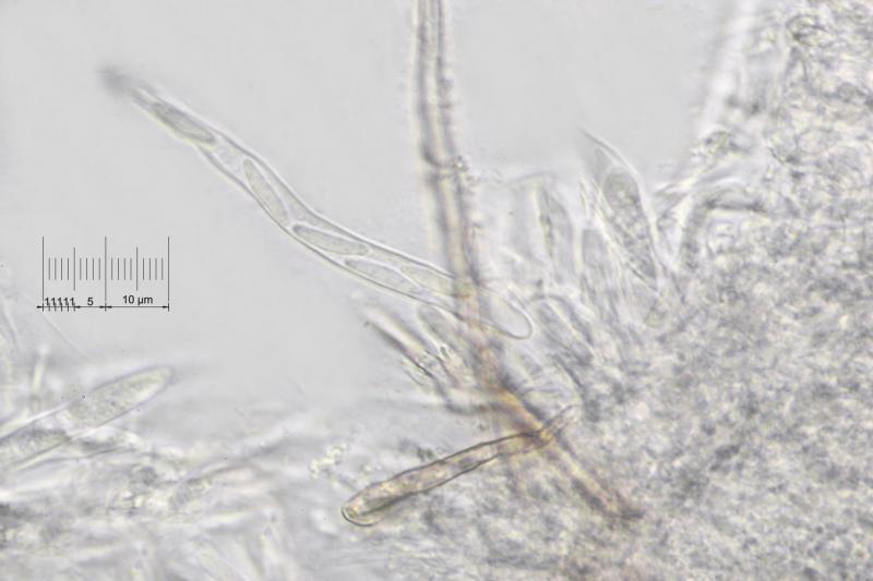 macrostoma