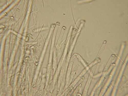 macrostoma